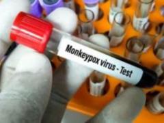 First case of monkeypox detected in Russia