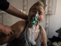 Источниками заражения устойчивыми к антибиотикам инфекциями могут быть аппараты ИВЛ