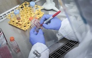 Scientists have found the cause of the outbreak of hepatitis in children
