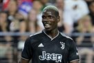 Pogba does not recommend surgery after meniscus injury