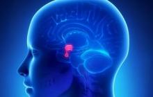 Indications for MRI of the veins of the brain
