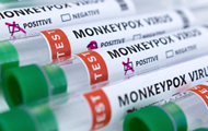 Monkeypox already in Moldova - media