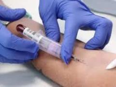 Three early signs of blood cancer in children: oncologist