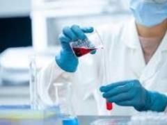 First death from monkeypox recorded in Europe