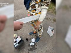 Ammunition detonated at an exhibition in Chernihiv: three children were injured