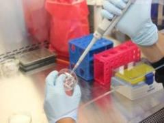 Борьба с ВИЧ: ученые разрабатывают антитела, способные перезапускать иммунитет