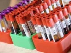 Проста звичка допоможе запобігти ризику розвитку діабету