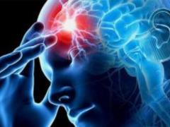 Signs of a small stroke called doctors