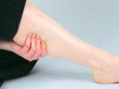 Symptoms of deep vein thrombosis can be seen on the legs