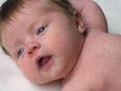 Likar called the signs of scarlet fever, as if it were expanding