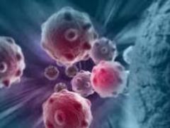 Oncologist named the way to recognize cancer by voice