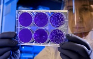 Coronavirus can be transmitted even after death - NYT