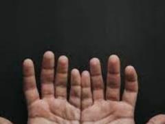 Doctors figured out how to determine the level of sugar in the palms of the hands