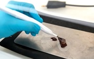 Created a device that instantly detects cervical cancer