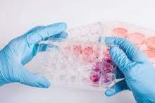 Treatment of osteoarthritis with stem cells: how to restore the joint and avoid arthroplasty