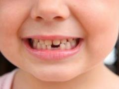 It is now necessary to fluoride water and what will be behind your teeth