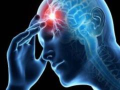 How to reduce the risk of a stroke: chotiri factors