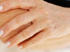 Эндокринолог Гуреева: желтые пятна на ладонях говорят о недостаточности гормонов щитовидки