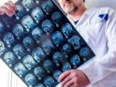 The expert told how the work of the brain can reduce weight