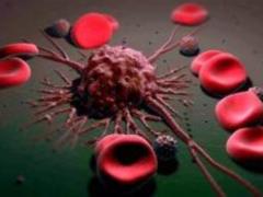 Oncologist Brown: you can detect cancer by one area of \u200b\u200bthe skin