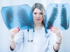 Oncologists from Canada named the most common symptoms of lung cancer