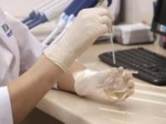 Nephrologist Yesayan: asymptomatic kidney disease can become a  