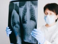 Oncologist Vorobyov: 4 signs of cancer that appear in the morning