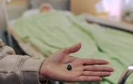Doctors took out a centimeter fragment from the brain of a wounded resident of Uman