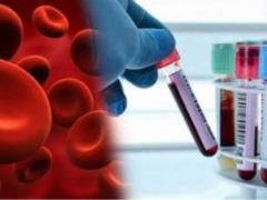 Doctors called unobvious signs of thick blood