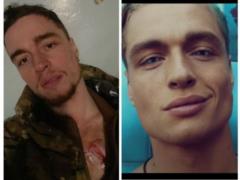 The star of the clip Loboda Nazar Grabar first told how he was wounded in the chest in the war: “I was in a plate carrier”