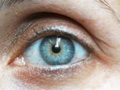 The doctor called 2 signs in the eyes that signal poor health