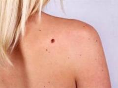 Dermatologist Lukasheva: skin problems can be a sign of serious illness