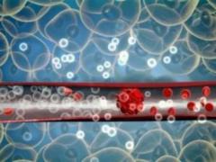 How to identify blood clots in the body: diagnostic methods and symptoms