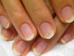 Tea tree oliya for nails: natural vision and glee