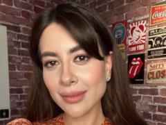 Ramina Eshakzai on an honest photo showed how she looked before beauty injections