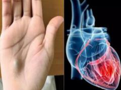 First symptom of fatty liver