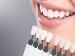 Teeth whitening: methods, advantages and recommendations