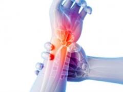 Therapy for gout: symptoms, causes and treatment
