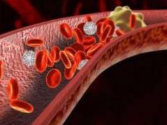5 sign of parasites in the body