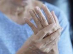 Remedies for rheumatoid arthritis