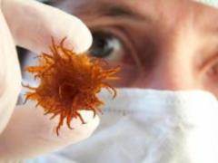 Habits that cause cancer