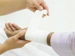 How to relieve pain after a burn