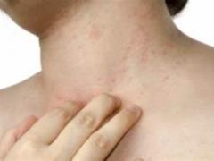 Rash on the body: causes
