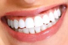 How to maintain white teeth at home: effective methods