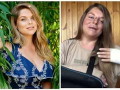 Nelya Shovkoplyas with a broken face and a broken arm shocked what happened to her