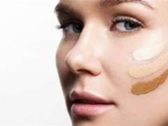 What is melasma?