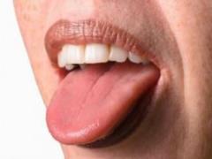 Сухость во рту: раскрыты биохимический механизм и перспективы лечения