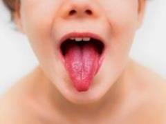 The outbreak of the scarlet fever epidemic in Kiev: symptoms and treatment