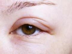 How to change the wound mark of exposure: Effective for the sake of