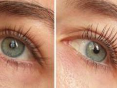 Syrup for eyebrow and hair growth: myth and reality? Commentary by cosmetologist-dermatologist Tetyana Kuzub